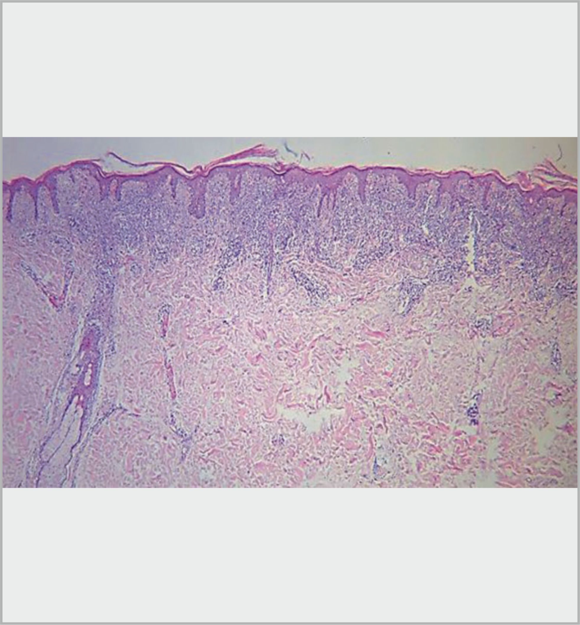 Fig. 16.4